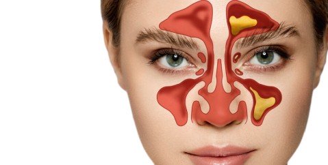 Seno paranasale infiammato: sintomi e cause