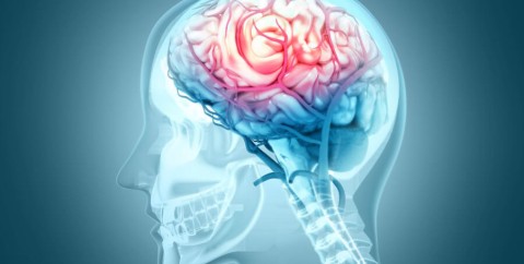 Ictus: sintomi iniziali a cui prestare attenzione