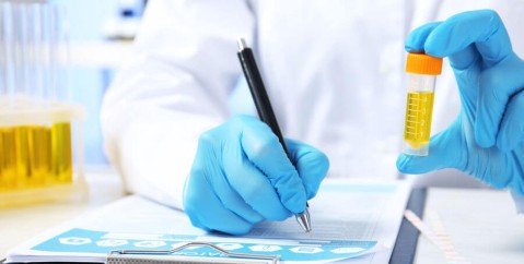 Esame urine: cosa si vede e come va effettuato?