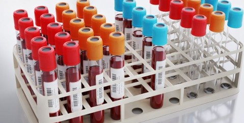 Analisi del sangue: come leggere i valori principali