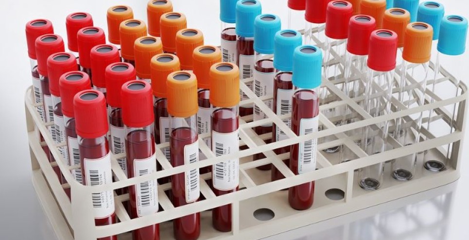 Analisi del sangue: come leggere i valori principali