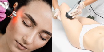 La radiofrequenza: a cosa serve, quando è indicata e quali risultati aspettarsi