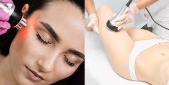 La radiofrequenza: a cosa serve, quando è indicata e quali risultati aspettarsi