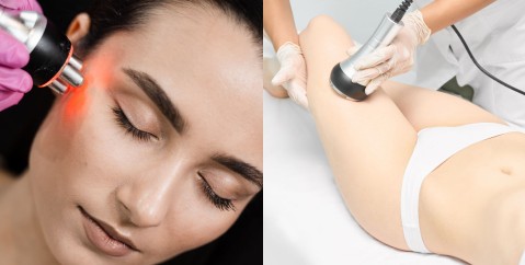 La radiofrequenza: a cosa serve, quando è indicata e quali risultati aspettarsi