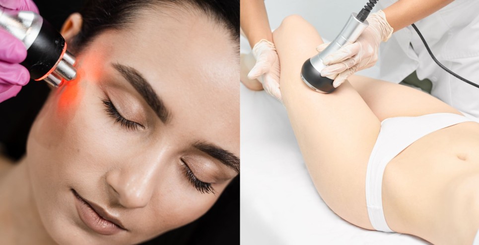 La radiofrequenza: a cosa serve, quando è indicata e quali risultati aspettarsi