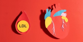 Colesterolo LDL: valori normali e quando preoccuparsi
